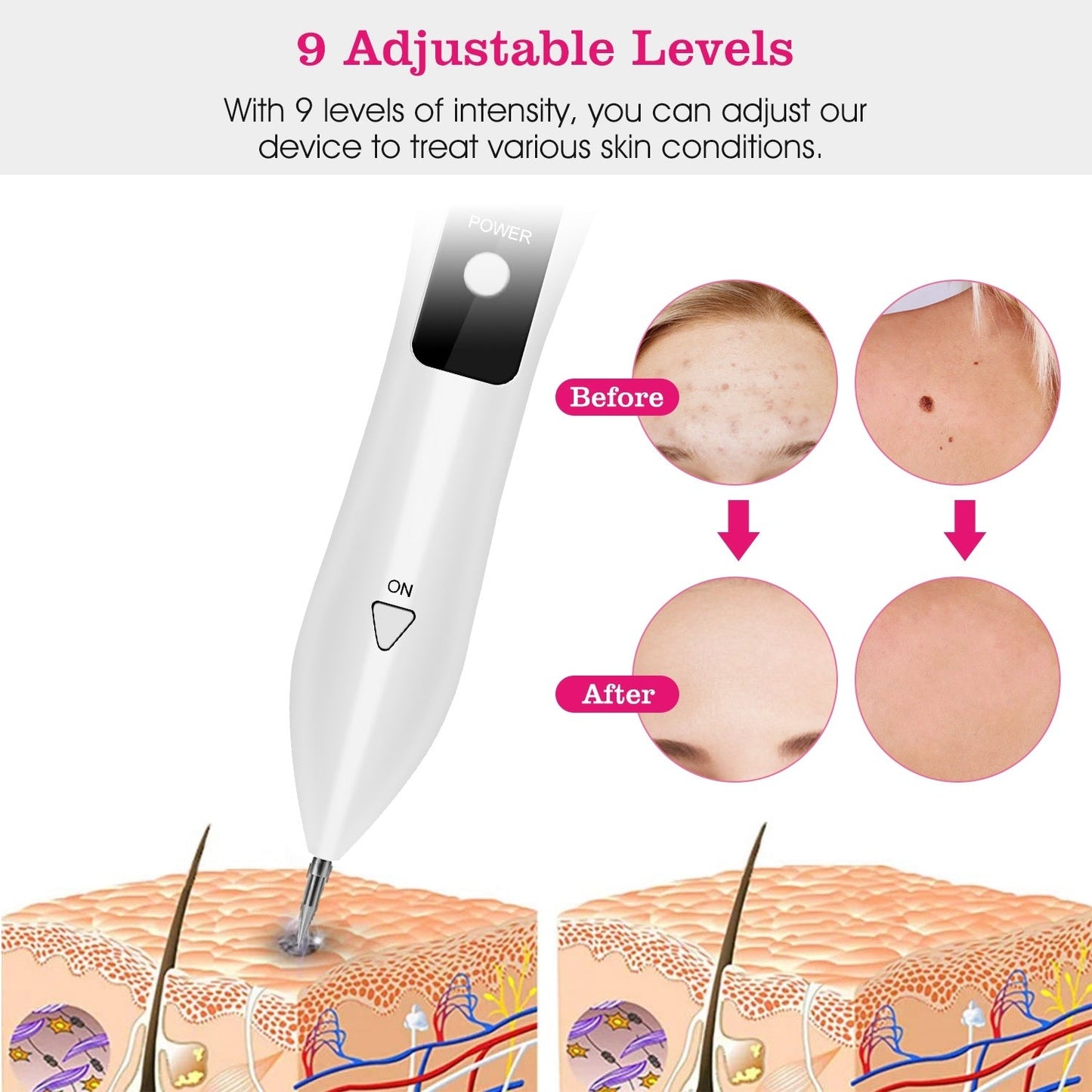Skin Tag Repair Kit Portable Beauty Equipment Multi-Level with Home